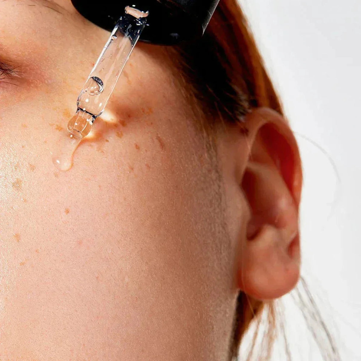 Pipette déposant une goutte du sérum COSRX The Niacinamide 15 sur une tempe constellée de taches de rousseur