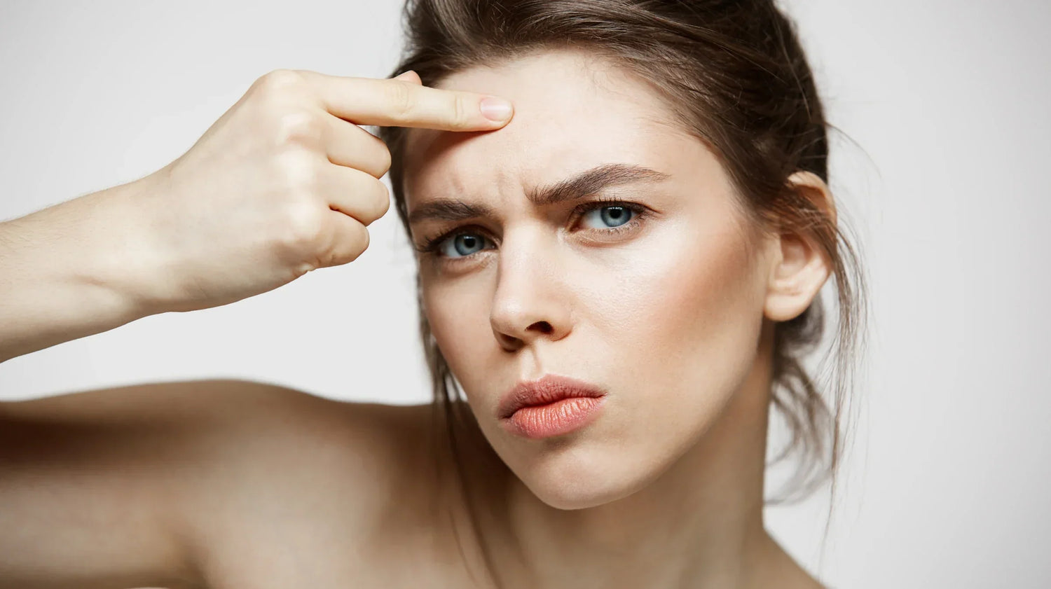 Comment traiter l'acné fongique ? Les traitements naturels ✅ - Holy Skin