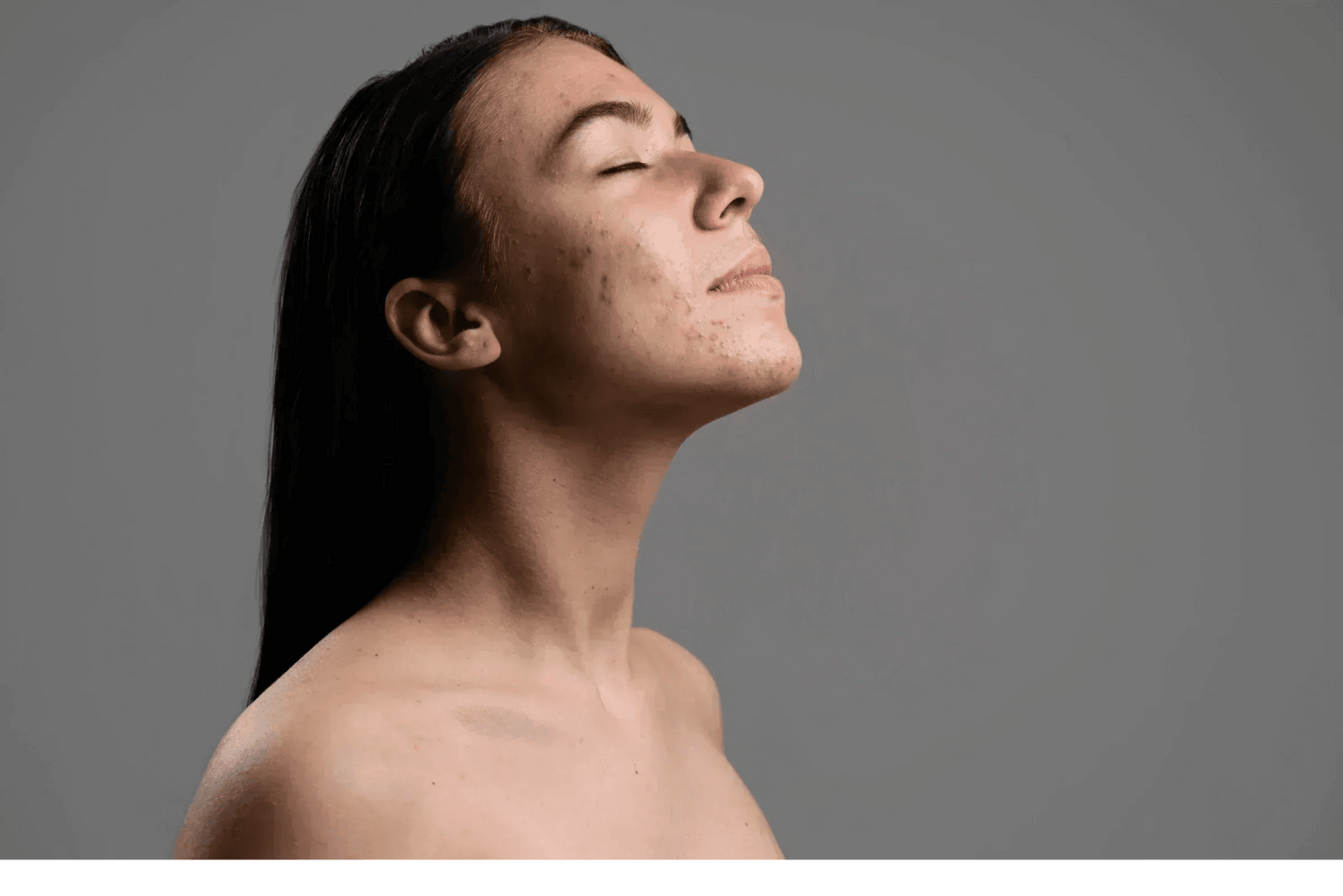 Comment éliminer les points noirs en moins de 5 minutes ? ⏰ - Holy Skin