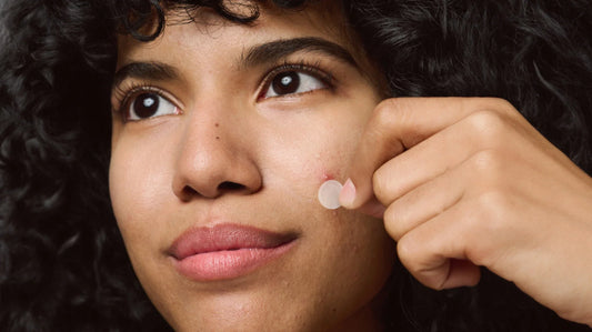 Quel est le meilleur patch bouton en 2025 ? 🔥