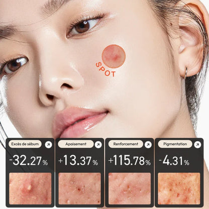 Anua - Heartleaf Centella Red Spot Cream