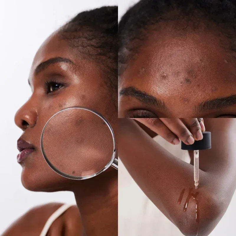 COSRX - The Alpha-Arbutin 2 Discoloration Care Serum - Holy Skin