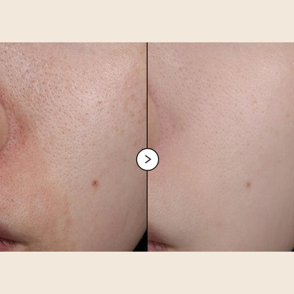 EQQUALBERRY - Vitamin Illuminating Serum