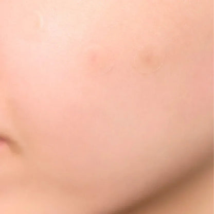 SKIN1004-Spot-Cover-Patch-2 - Holy Skin
